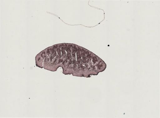 Turbellaria