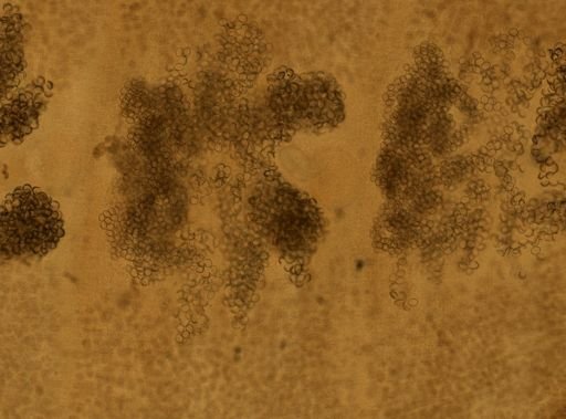 Diphyllobothrium latum