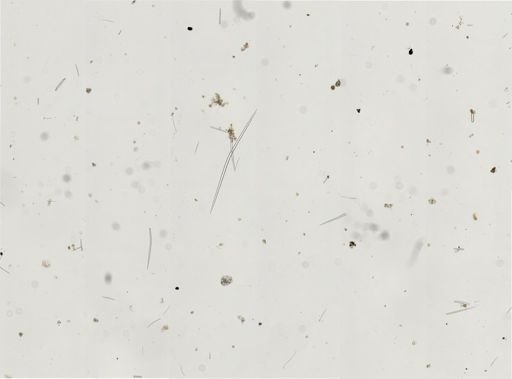Porifera?