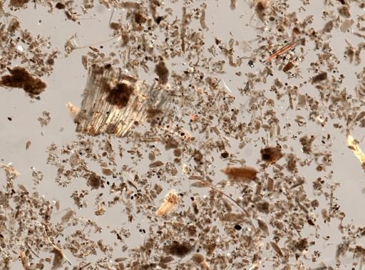 Balantidium coli