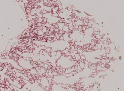 Haliclona