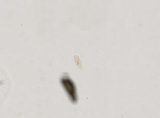 Paramecium multimicronucleatum