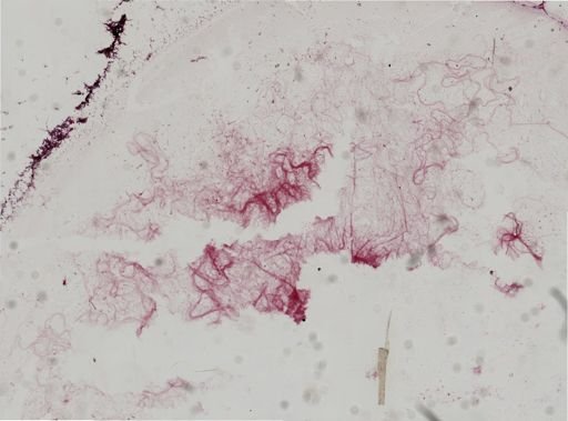 Bacillus
