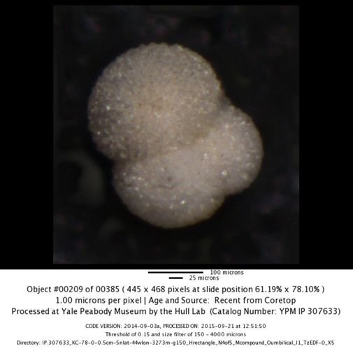 Globigerinoides sacculifer