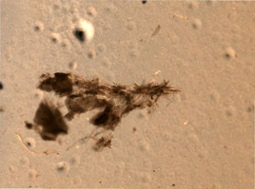 Bryozoa