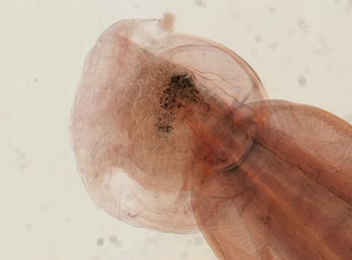 Oligacanthorhynchus microcephalus