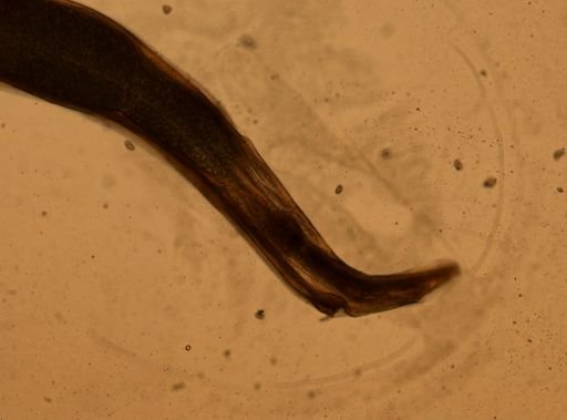 Enterobius vermicularis