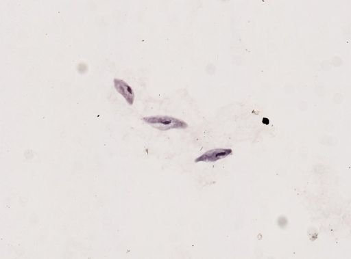 Paramecium multimicronucleatum