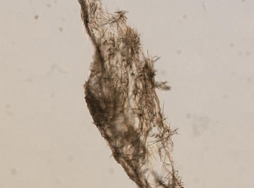 Halichondria sp.