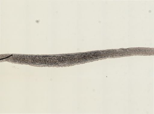 Turbellaria