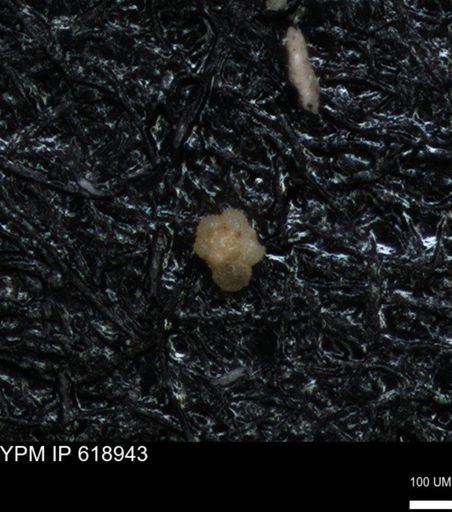 undet. Rugoglobigerinidae