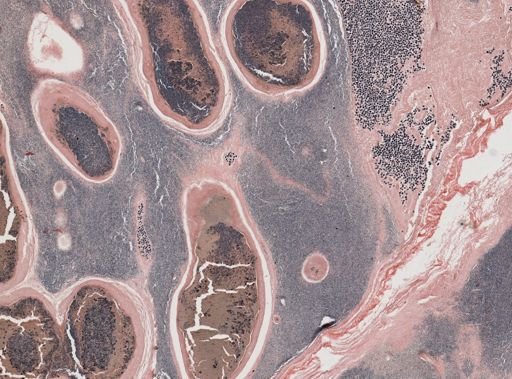 Ichthyosporidium