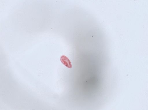 Paramecium aurelia