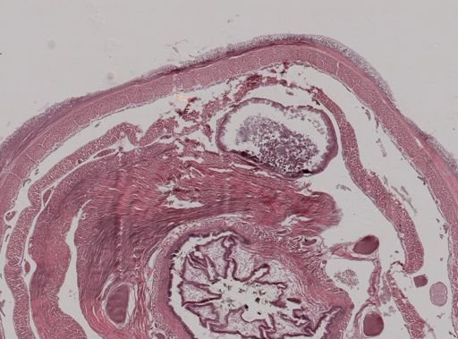 Amynthas heterochaetus