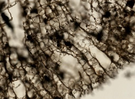 Callyspongia vaginalis