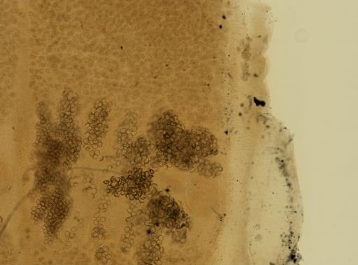 Diphyllobothrium latum