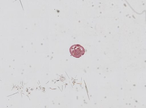 Nematostella