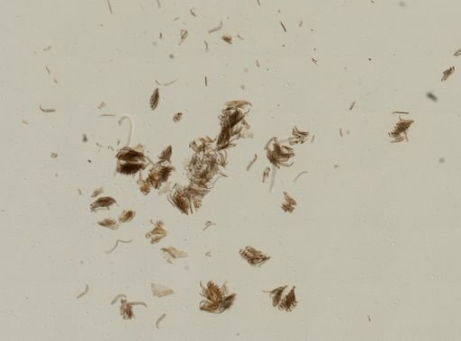 Bithynia tentaculata