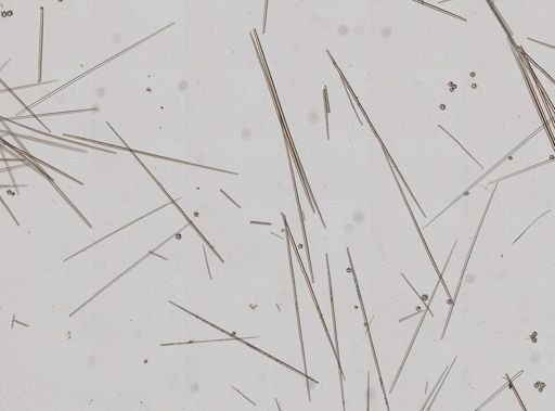 Tethya actinia