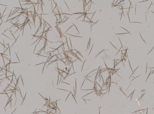 Ephydatia fluviatilis?