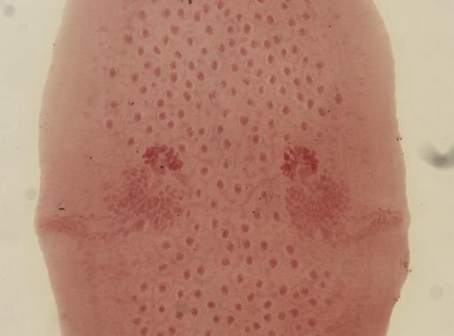 Dipylidium caninum