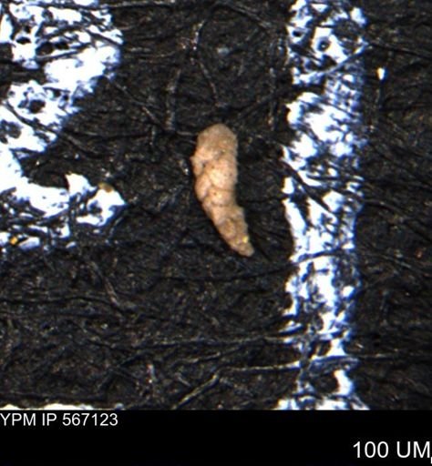 Verneuilina canadensis