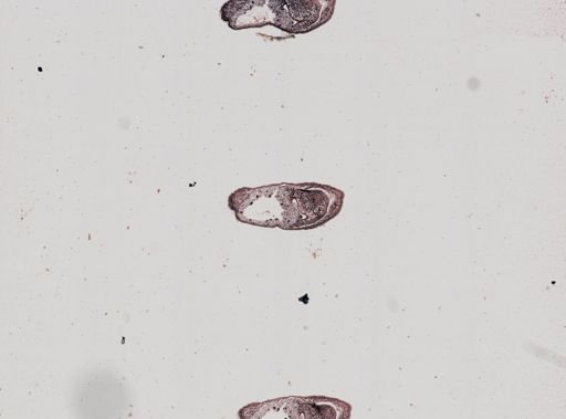 Plagiostomum whitmani