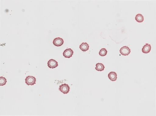 Edwardsia sp.
