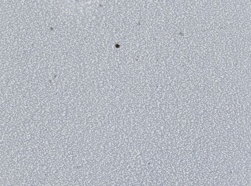 Plasmodium vivax