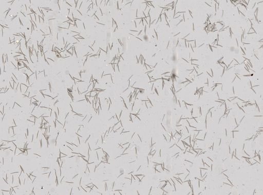Haliclona oculata