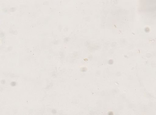 Paramecium trichium