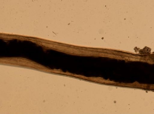 Ancylostoma caninum