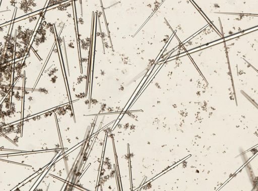 Tectitethya crypta