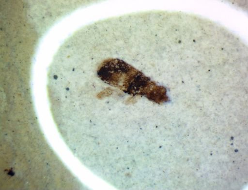 undet. Hexapoda