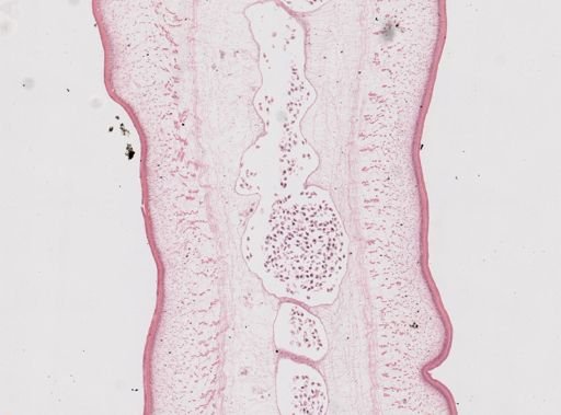 Taenia saginata