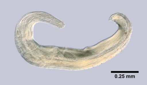 Enterobius vermicularis