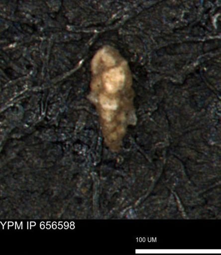Verneuilina canadensis