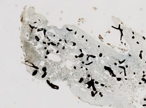 Lendenfeldia chondrodes