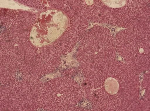 Eimeria stiedae