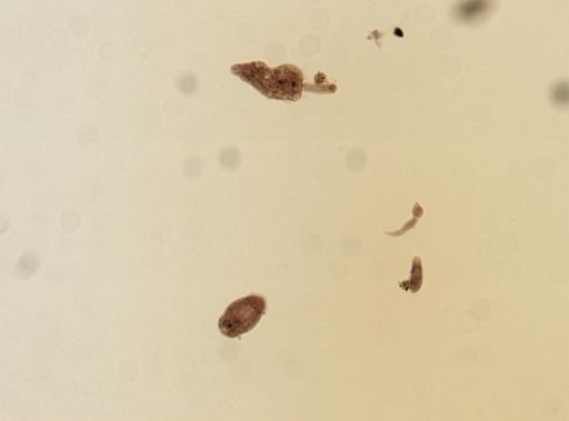 Echinostomatidae