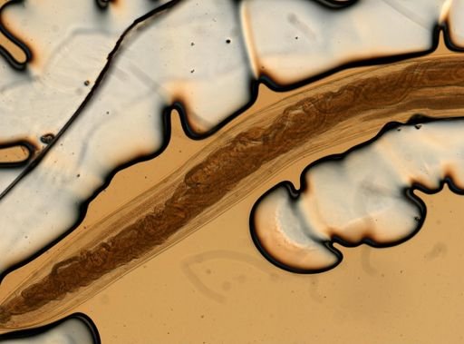 Ancylostoma caninum