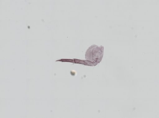 Hyalella cf. azteca