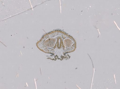 Paradinonemertes drygalskii