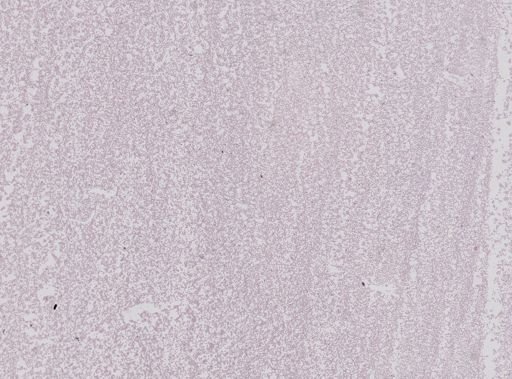Plasmodium falciparum