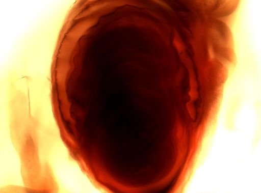 Taenia solium