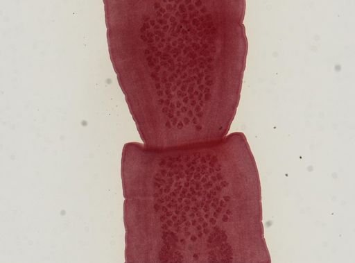 Dipylidium caninum