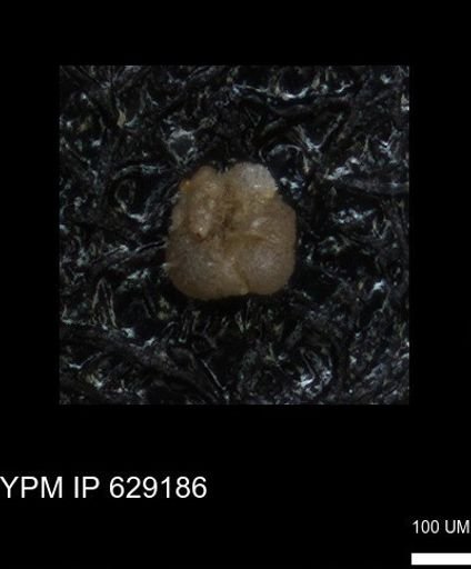 undet. Foraminiferida