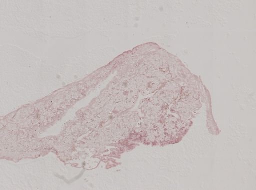 Modiolus