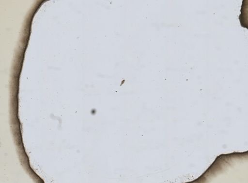 Trichotria pocillum
