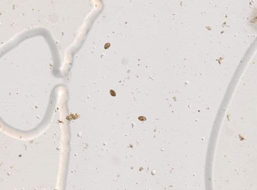 Diphyllobothrium canis